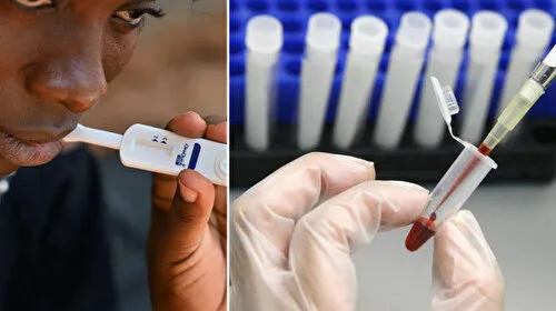 HIV Tedavisinde Çığır Açan Buluş! Virüs Hücre İçinde Görünür Oldu