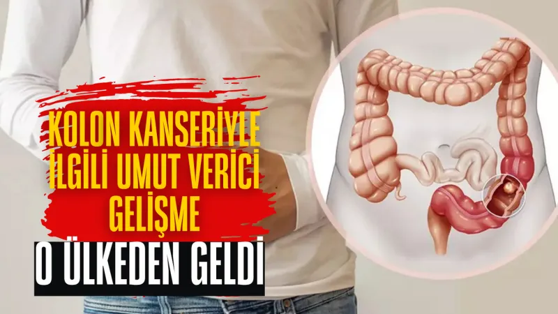 Kolon Kanserine Karşı Yeni Genetik Yöntem Geliştirildi